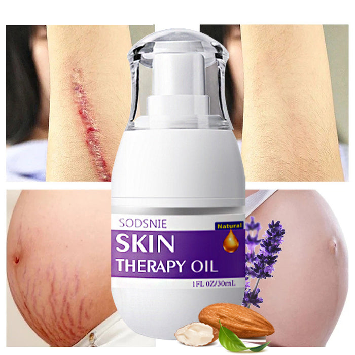 Skin Therapy Oil Scars and Stretch Marks Removal Serum Moisturizing Firming Body Care